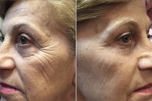Antes x Depois.11webp