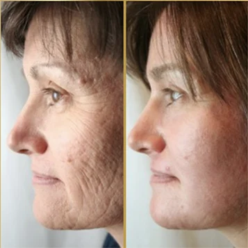 Antes x Depois.2webp
