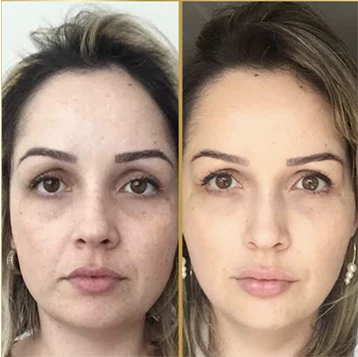 Antes x Depois.4webp