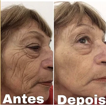 Antes x Depois.5webp
