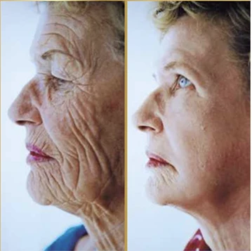 Antes x Depois.6webp