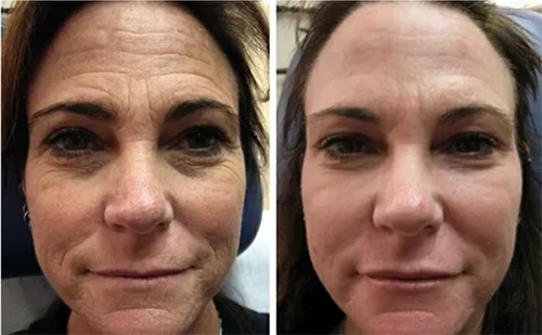Antes x Depois.9webp
